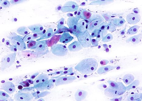 Células parabasales. Células redondas u ovales con núcleo relativamente agrandado y citoplasma denso, escaso y cianófilo.