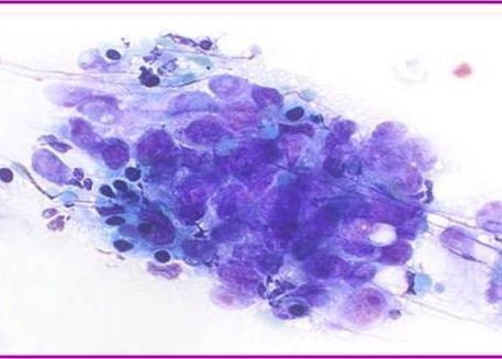 Grupo de células con citoplasma amplio bien definido