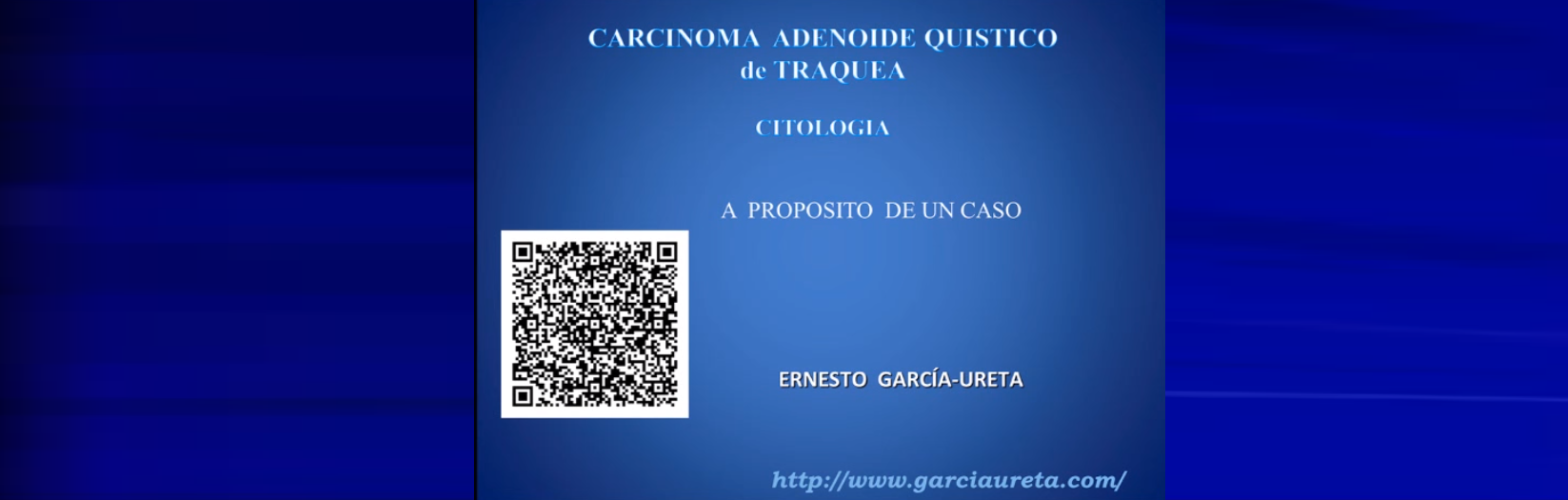 Carcinoma Adenoide Quistico