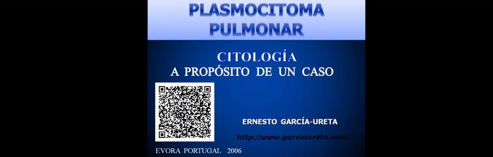Citología plasmocitoma primario de pulmón