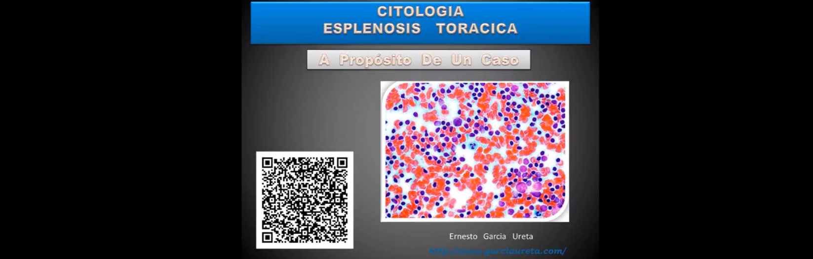 Esplenosis Toracica