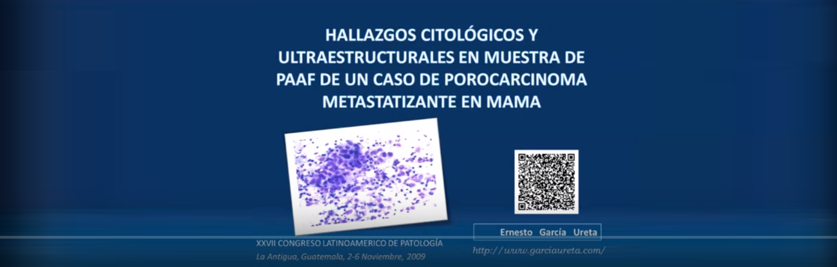 Porocarcinoma metastatizante en mama