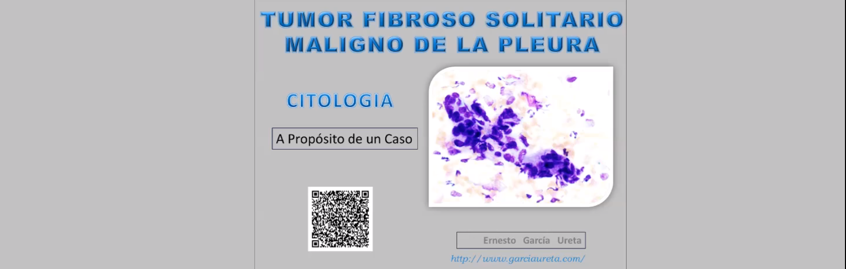 Tumor Fibroso Solitario Maligno de la Pleura