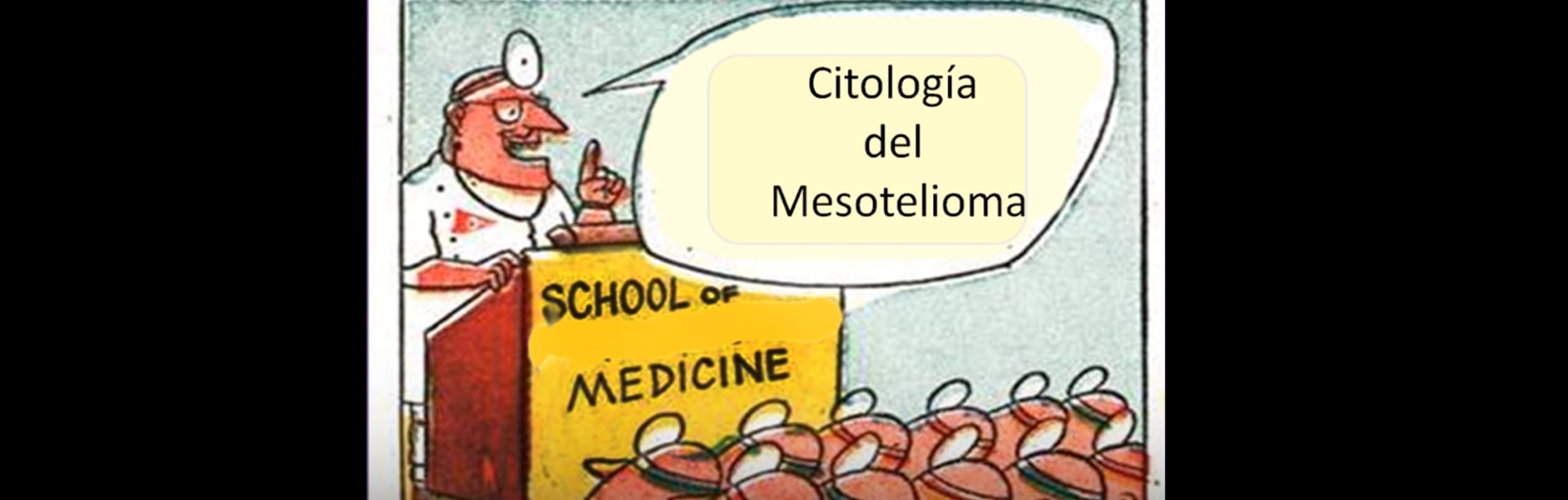 Mesotelioma