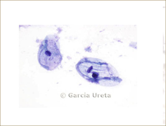 GYNECOLOGIC CYTOLOGY