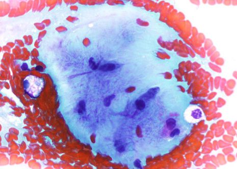 Stromal cells with oval or elongated nuclei embedded in abundant fibrillar intercelular substance.