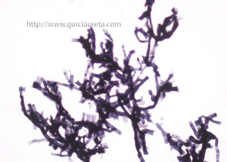 Aspergillus hyphae stained with Grocott´s method.