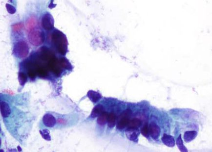 Células columnares endocervicais con barra terminal e cilios.