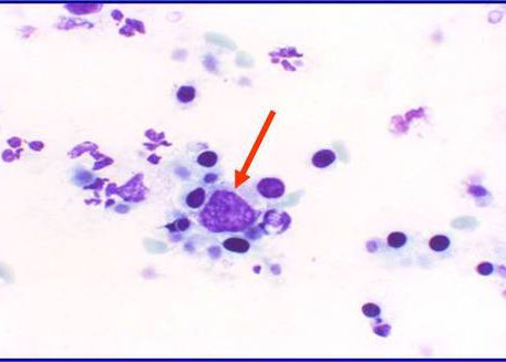 Mitosis figure.