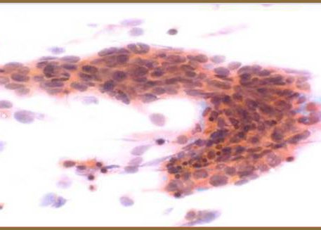 Cuticular cells with moderate cytoplasm.