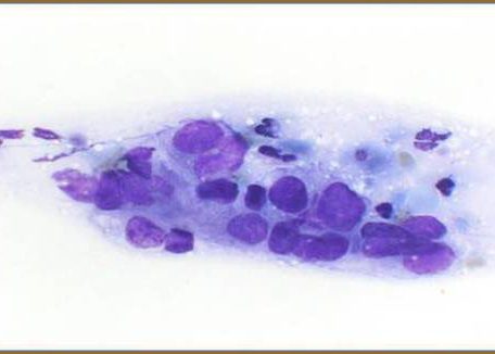 Células poroides