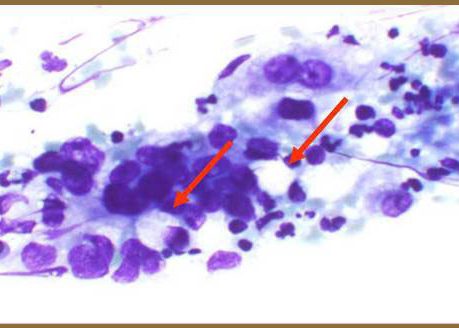 Cluster of cells with intercellular lumina