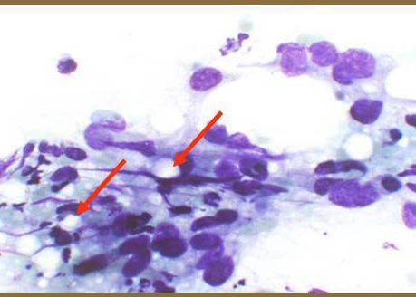 Cells forming intercellular lumena