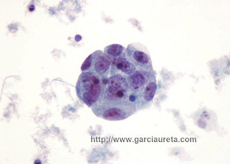 A rounded cluster. The cells have a monotonous appearance. Several nucleoli can be identified in some nuclei.