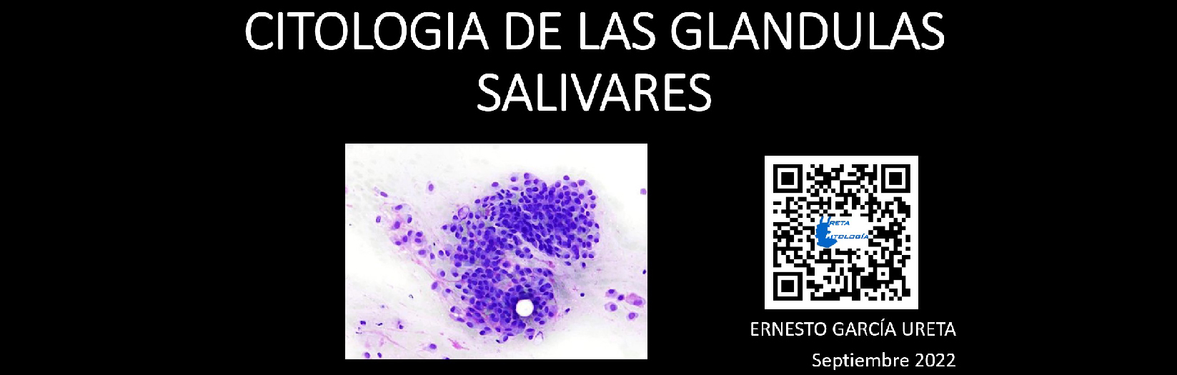 Citología de las Glándulas Salivales
